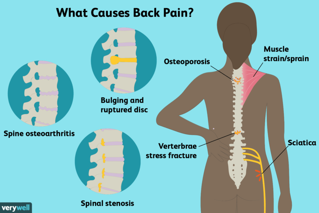 Sakit pinggang belakang tengah