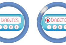 Jenis-diabetes