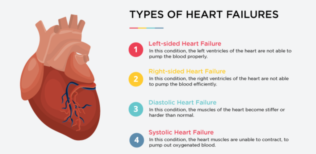 Jenis jenis gagal jantung